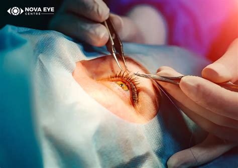 cataract surgery in huddersfield|Huddersfield: 10 expert Ophthalmologists for cataract surgery.